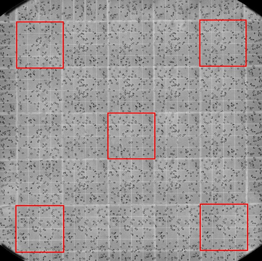 RBC Neubauer's Chamber